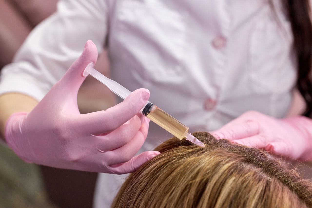 PRP hair treatment injection for hair loss